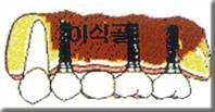 증례 비교6